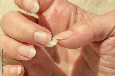 Broken nail. Natural long nails without polish. Cracked, chipped nail. Female fingernails polish-free.